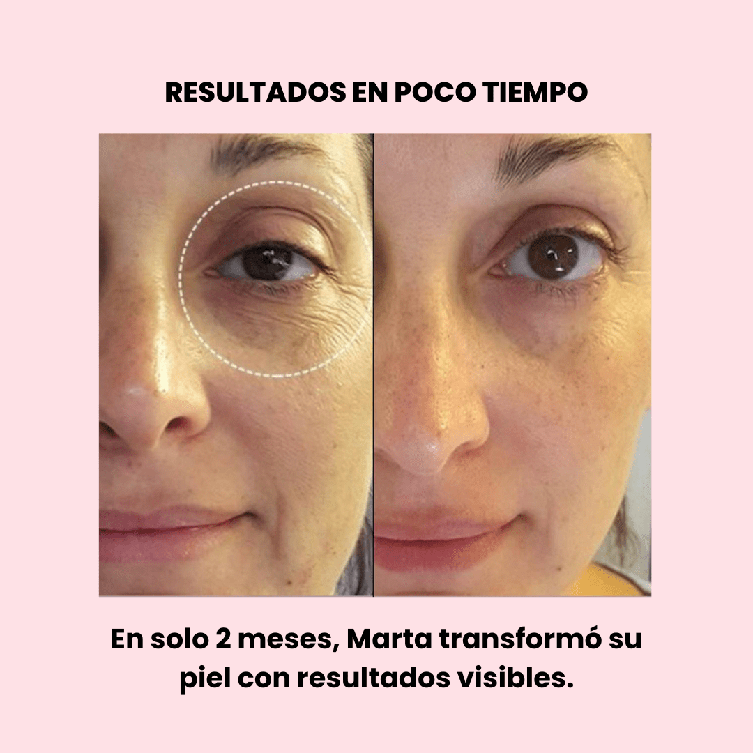 Serum de Bio-Retinol