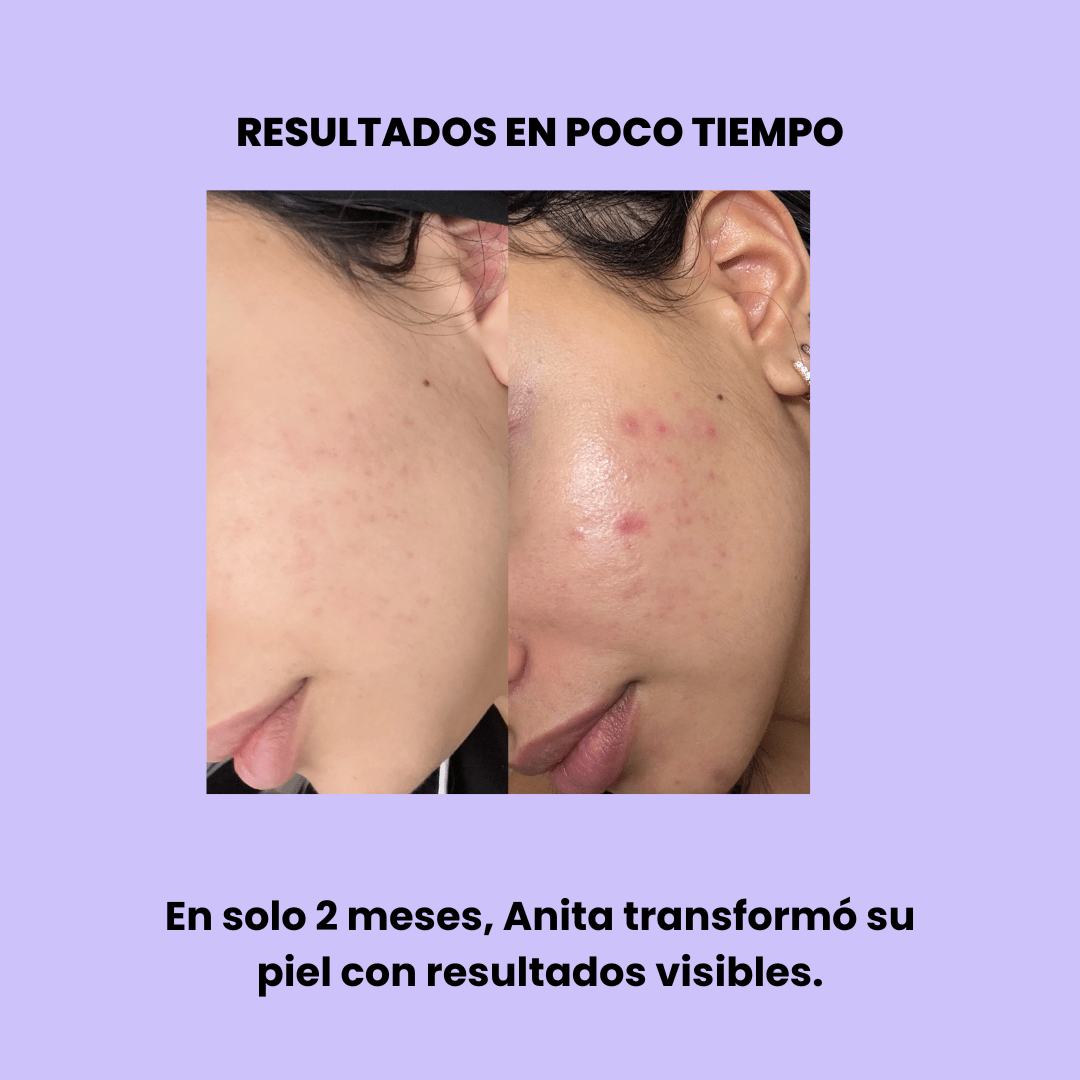 Serum con Niacinamida 10%